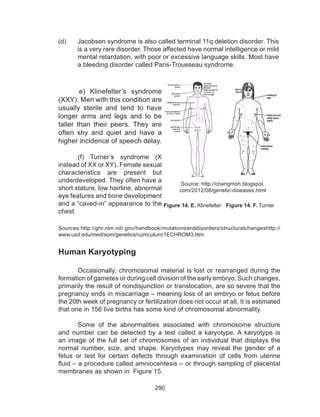 290
e) Klinefelter’s syndrome
(XXY). Men with this condition are
usually sterile and tend to have
longer arms and legs and to be
taller than their peers. They are
often shy and quiet and have a
higher incidence of speech delay.
(f) Turner’s syndrome (X
instead of XX or XY). Female sexual
characteristics are present but
underdeveloped. They often have a
short stature, low hairline, abnormal
eye features and bone development
and a “caved-in” appearance to the
chest
Figure 14. F. TurnerFigure 14. E. Klinefelter
Source: http://chengmoh.blogspot.
com/2012/08/genetic-diseases.html
Sources:http://ghr.nlm.nih.gov/handbook/mutationsanddisorders/structuralchangeshttp://
www.usd.edu/med/som/genetics/curriculum/1ECHROM3.htm
Human Karyotyping
	 Occasionally, chromosomal material is lost or rearranged during the
formation of gametes or during cell division of the early embryo. Such changes,
primarily the result of nondisjunction or translocation, are so severe that the
pregnancy ends in miscarriage – meaning loss of an embryo or fetus before
the 20th week of pregnancy or fertilization does not occur at all. It is estimated
that one in 156 live births has some kind of chromosomal abnormality.
	 Some of the abnormalities associated with chromosome structure
and number can be detected by a test called a karyotype. A karyotype is
an image of the full set of chromosomes of an individual that displays the
normal number, size, and shape. Karyotypes may reveal the gender of a
fetus or test for certain defects through examination of cells from uterine
fluid – a procedure called amniocentesis – or through sampling of placental
membranes as shown in Figure 15.
(d) 	 Jacobsen syndrome is also called terminal 11q deletion disorder. This
is a very rare disorder. Those affected have normal intelligence or mild
mental retardation, with poor or excessive language skills. Most have
a bleeding disorder called Paris-Trousseau syndrome.
 