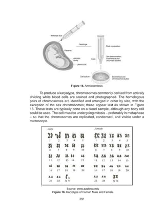 291
Figure 15. Amniocentesis
To produce a karyotype, chromosomes commonly derived from actively
dividing white blood cells are stained and photographed. The homologous
pairs of chromosomes are identified and arranged in order by size, with the
exception of the sex chromosomes; these appear last as shown in Figure
16. These tests are typically done on a blood sample, although any body cell
could be used. The cell must be undergoing mitosis – preferably in metaphase
– so that the chromosomes are replicated, condensed, and visible under a
microscope.
Source: www.austincc.edu
Figure 16. Karyotype of Human Male and Female
 