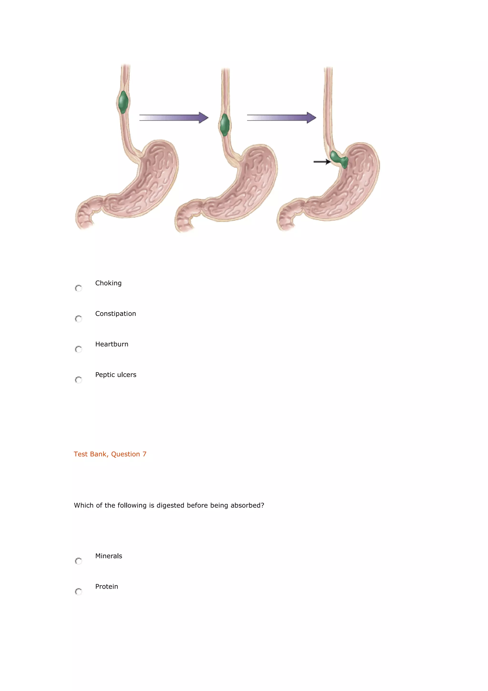 Choking
Constipation
Heartburn
Peptic ulcers
Test Bank, Question 7
Which of the following is digested before being absorbed?
Minerals
Protein
 
