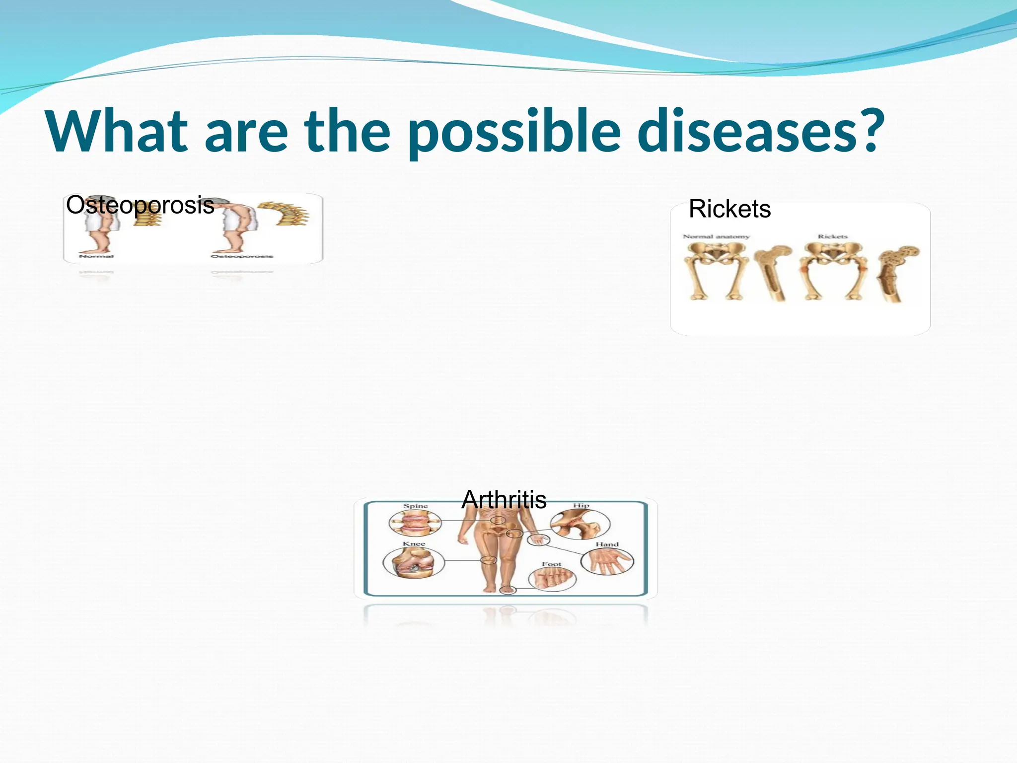 What are the possible diseases?
Osteoporosis Rickets
Arthritis
 