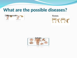 What are the possible diseases?
Osteoporosis Rickets
Arthritis
 