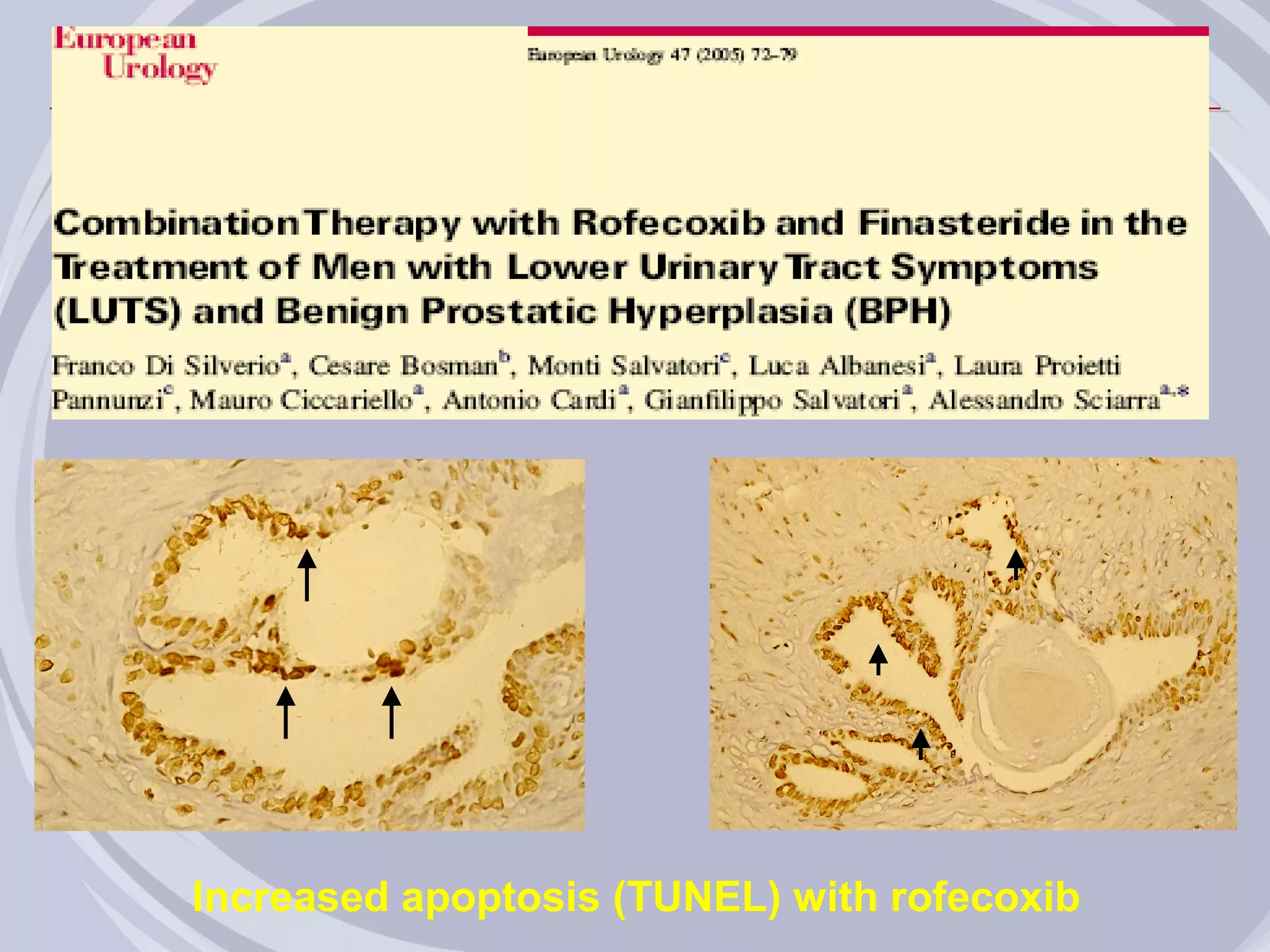 Increased apoptosis (TUNEL) with rofecoxib
 