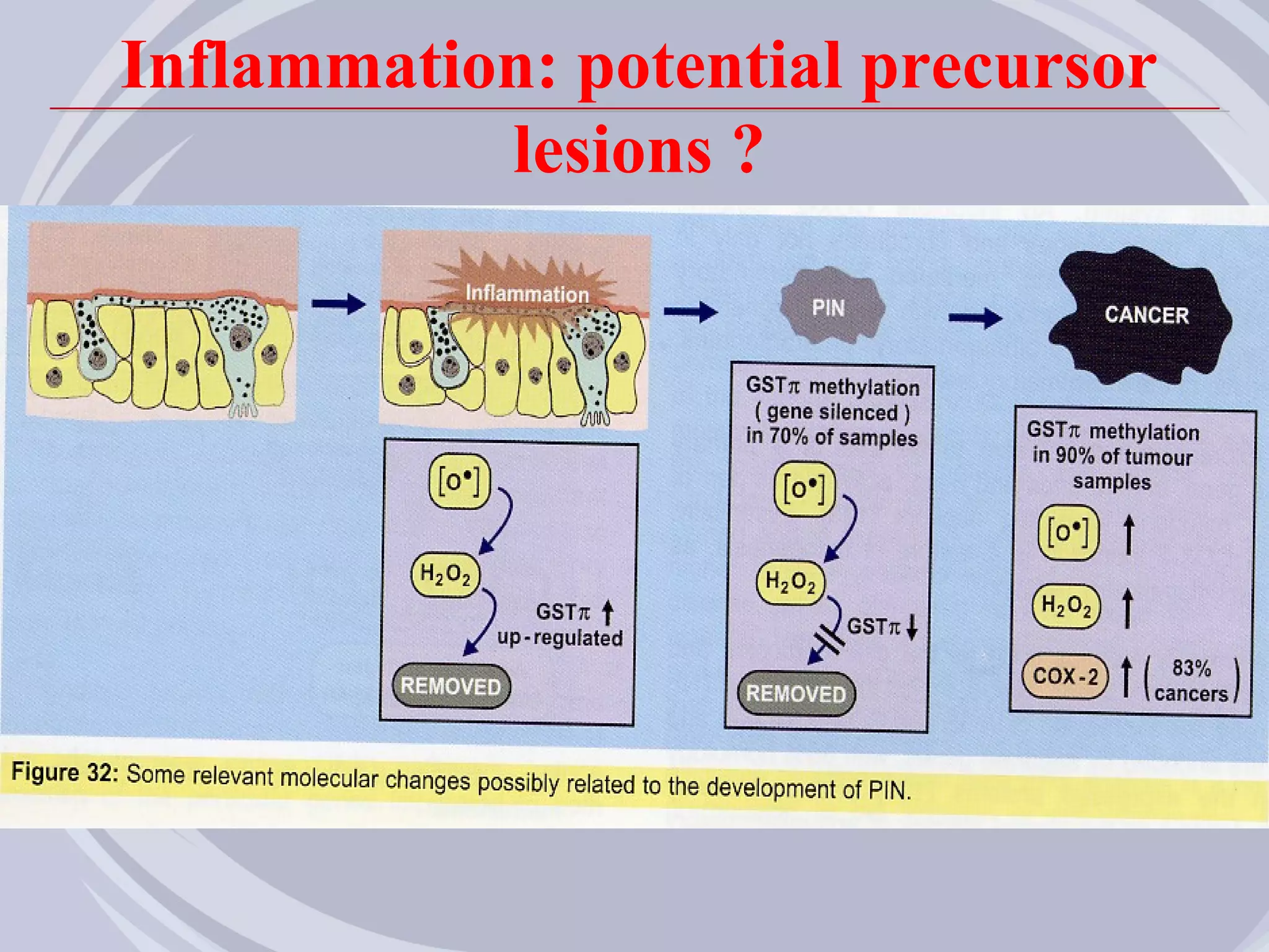 Inflammation: potential precursor
           lesions ?
 