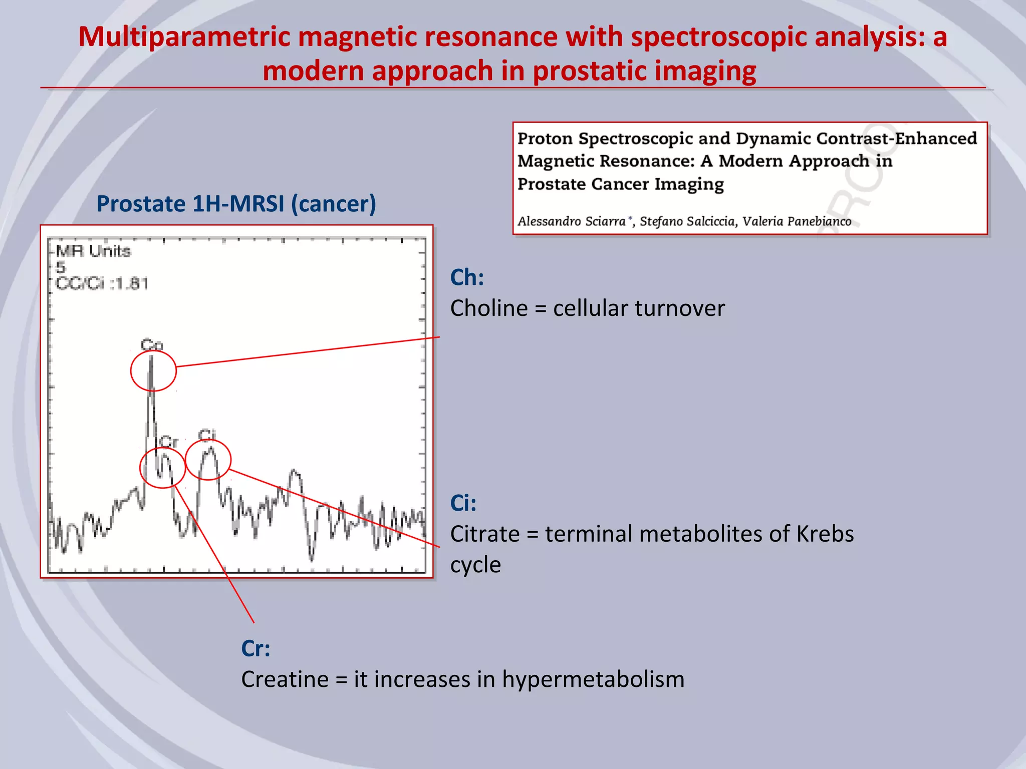 Multiparametric magnetic resonance with spectroscopic analysis: a
            modern approach in prostatic imaging



 Prostate 1H-MRSI (cancer)

                                Ch:
                                Choline = cellular turnover




                                Ci:
                                Citrate = terminal metabolites of Krebs
                                cycle


             Cr:
             Creatine = it increases in hypermetabolism
 