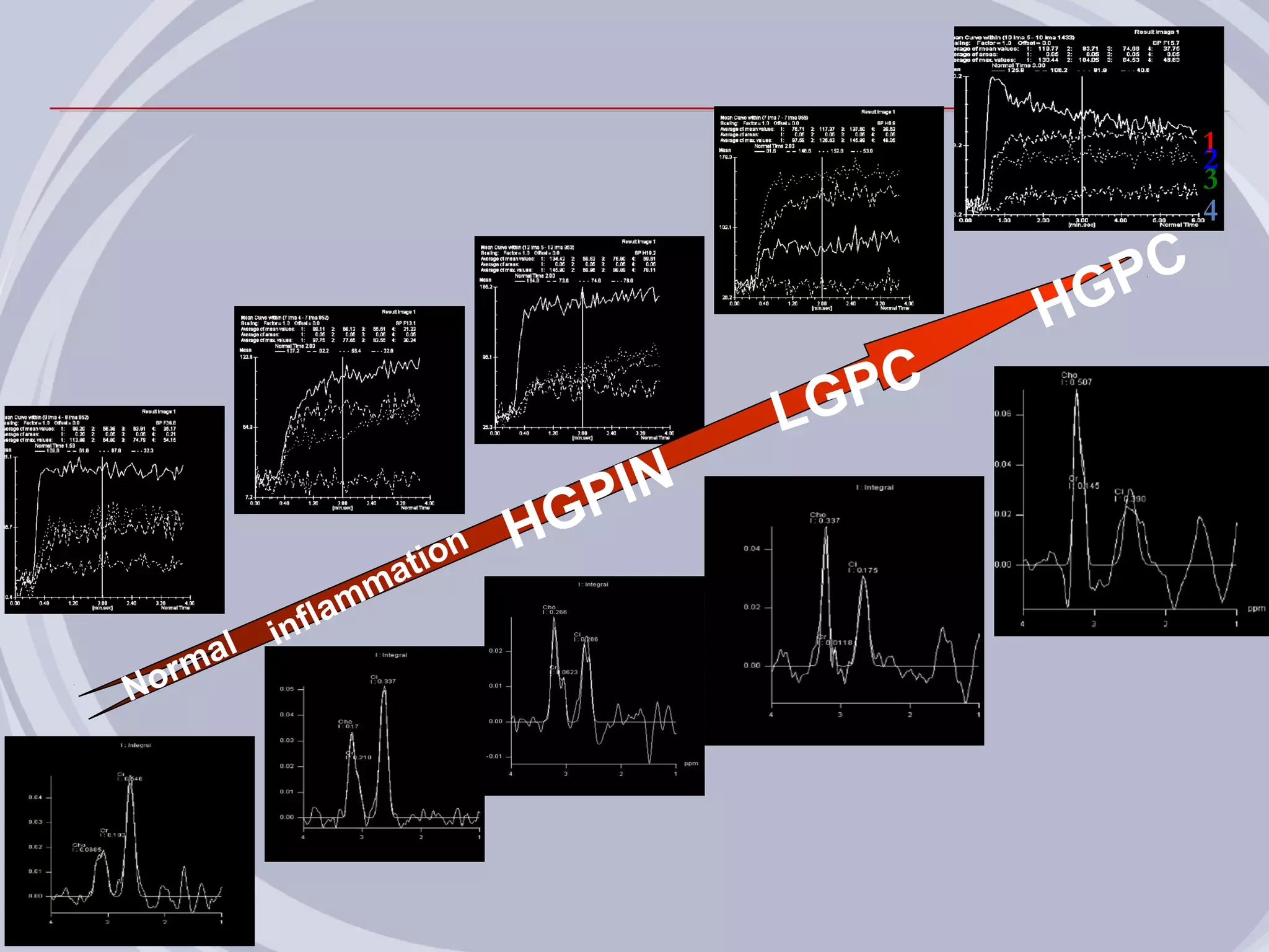 1
                                                         2
                                                         3
                                                         4

                                                  G PC
                                              H
                                       LGPC
                                 PIN
                       tio
                          n   HG
                   mma
            in fla
        l
   r ma
No
 