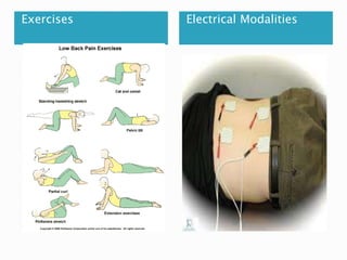 Exercises Electrical Modalities
 