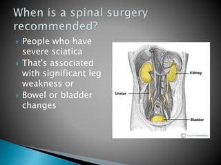  People who have
severe sciatica
 That's associated
with significant leg
weakness or
 Bowel or bladder
changes
 