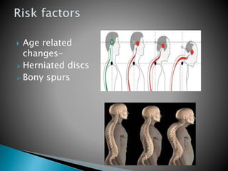  Age related
changes-
 Herniated discs
 Bony spurs
 