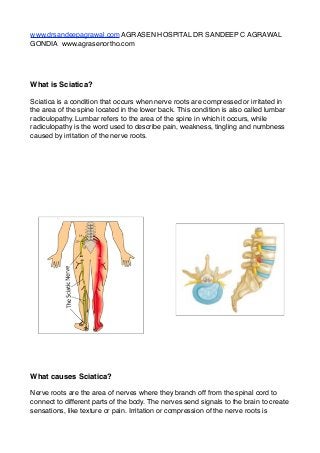 www.drsandeepagrawal.com AGRASEN HOSPITAL DR SANDEEP C AGRAWAL
GONDIA  www.agrasenortho.com"
"
"
What is Sciatica?!
Sciatica is a condition that occurs when nerve roots are compressed or irritated in
the area of the spine located in the lower back. This condition is also called lumbar
radiculopathy. Lumbar refers to the area of the spine in which it occurs, while
radiculopathy is the word used to describe pain, weakness, tingling and numbness
caused by irritation of the nerve roots."
"
"
"
"
"
"
"
What causes Sciatica?!
Nerve roots are the area of nerves where they branch off from the spinal cord to
connect to different parts of the body. The nerves send signals to the brain to create
sensations, like texture or pain. Irritation or compression of the nerve roots is
 