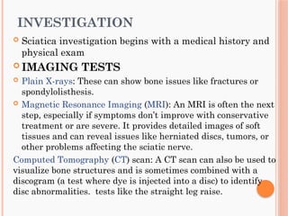SCIATICA case based learning integrated part | PPTX