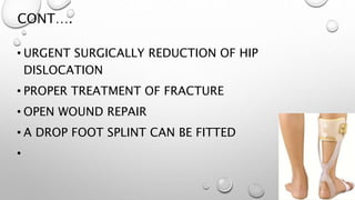 CONT….
• URGENT SURGICALLY REDUCTION OF HIP
DISLOCATION
• PROPER TREATMENT OF FRACTURE
• OPEN WOUND REPAIR
• A DROP FOOT SPLINT CAN BE FITTED
•
 