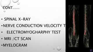 CONT……
• SPINAL X-RAY
•NERVE CONDUCTION VELOCITY TEST/
• ELECTROMYOGHARPHY TEST
• MRI /CT SCAN
•MYELOGRAM
 
