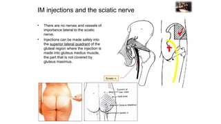 Sciatic Window Comprehensive Overview of Sciatic Nerve Injury and Anatomy | PPTX