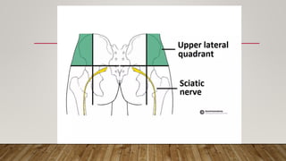Sciatic Nerve PDF