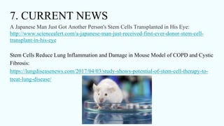 7. CURRENT NEWS
A Japanese Man Just Got Another Person's Stem Cells Transplanted in His Eye:
http://www.sciencealert.com/a-japanese-man-just-received-first-ever-donor-stem-cell-
transplant-in-his-eye
Stem Cells Reduce Lung Inflammation and Damage in Mouse Model of COPD and Cystic
Fibrosis:
https://lungdiseasenews.com/2017/04/03/study-shows-potential-of-stem-cell-therapy-to-
treat-lung-disease/
 