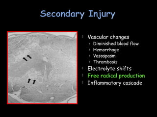  Vascular changes
› Diminished blood flow
› Hemorrhage
› Vasospasm
› Thrombosis
 Electrolyte shifts
 Free radical production
 Inflammatory cascade
 
