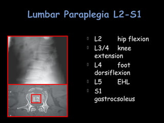  L2 hip flexion
 L3/4 knee
extension
 L4 foot
dorsiflexion
 L5 EHL
 S1
gastrocsoleus
L2
L2
 
