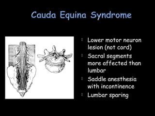  Lower motor neuron
lesion (not cord)
 Sacral segments
more affected than
lumbar
 Saddle anesthesia
with incontinence
 Lumbar sparing
 