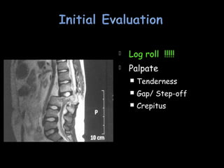  Log roll !!!!!
 Palpate
 Tenderness
 Gap/ Step-off
 Crepitus
 