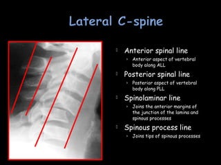  Anterior spinal line
› Anterior aspect of vertebral
body along ALL
 Posterior spinal line
› Posterior aspect of vertebral
body along PLL
 Spinolaminar line
› Joins the anterior margins of
the junction of the lamina and
spinous processes
 Spinous process line
› Joins tips of spinous processes
 