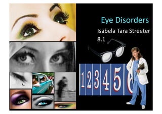 Eye Disorders 
Isabela Tara Streeter 
8.1 
 