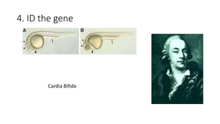 4. ID the gene
Cardia Bifida
 