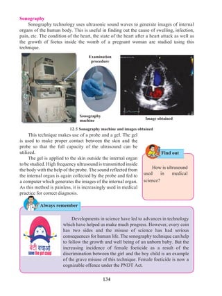 134
Sonography
	 Sonography technology uses ultrasonic sound waves to generate images of internal
organs of the human body. This is useful in finding out the cause of swelling, infection,
pain, etc. The condition of the heart, the state of the heart after a heart attack as well as
the growth of foetus inside the womb of a pregnant woman are studied using this
technique. 		
Find out
12.5 Sonography machine and images obtained
	 This technique makes use of a probe and a gel. The gel
is used to make proper contact between the skin and the
probe so that the full capacity of the ultrasound can be
utilized.
	 The gel is applied to the skin outside the internal organ
to be studied. High frequency ultrasound is transmitted inside
the body with the help of the probe. The sound reflected from
the internal organ is again collected by the probe and fed to
a computer which generates the images of the internal organ.
As this method is painless, it is increasingly used in medical
practice for correct diagnosis.
	 How is ultrasound
used in medical
science?
Image obtained
Examination
procedure
Sonography
machine
	 Developments in science have led to advances in technology
which have helped us make much progress. However, every coin
has two sides and the misuse of science has had serious
consequences for human life. The sonography technique can help
to follow the growth and well being of an unborn baby. But the
increasing incidence of female foeticide as a result of the
discrimination between the girl and the boy child is an example
of the grave misuse of this technique. Female foeticide is now a
cognizable offence under the PNDT Act.
Always remember
 