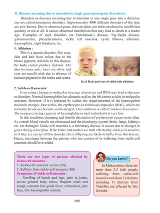 190
B. Diseases occuring due to mutation in single gene (monogenic disorders) :
	 Disorders or diseases occurring due to mutation in any single gene into a defective
one are called monogenic disorders. Approximately 4000 different disorders of this type
are now known. Due to abnormal genes, their products are either produced in insufficient
quantity or not at all. It causes abnormal metabolism that may lead to death at a tender
age. Examples of such disorders are Hutchinson’s disease, Tay-Sachs disease,
galactosaemia, phenylketonuria, sickle cell anaemia, cystic fibrosis, albinism,
haemophilia, night blindness, etc.
1. Albinism :
	 This is a genetic disorder. Our eyes,
skin and hair have colour due to the
brown pigment, melanin. In this disease,
the body cannot produce melanin. The
skin becomes pale, hairs are white and
eyes are usually pink due to absence of
melanin pigment in the retina and sclera.
16.11 Hair and eyes of child with albinism
2. Sickle-cell anaemia :
	 Even minor changes in molecular structure of proteins and DNA may lead to diseases
or disorders. Normal haemoglobin has glutamic acid as the 6th amino acid in its molecular
structure. However, if it is replaced by valine, the shape/structure of the haemoglobin
molecule changes. Due to this, the erythrocytes or red blood corpuscles (RBC), which are
normally biconcave become sickle-shaped. This condition is called ‘sickle-cell anaemia’.
The oxygen carrying capacity of haemoglobin in such individuals is very low.
	 In this condition, clumping and thereby destruction of erythrocytes occurs most often.
As a result blood vessels are obstructed and the circulatory system, brain, lungs, kidneys,
etc. are damaged. Sickle-cell anaemia is a hereditary disease. It occurs due to changes in
genes during conception. If the father and mother are both affected by sickle-cell anaemia
or if they are carriers of this disorder, their offspring are likely to suffer from this disease.
Hence, marriages between the persons who are carriers of or suffering from sickle-cell
anaemia should be avoided.
There are two types of persons affected by
sickle-cell anaemia :
1. Sickle-cell anaemia carrier (AS)
2. Sufferer from sickle-cell anaemia (SS)
Symptoms of sickle-cell anaemia :
	 Swelling of hands and legs, pain in joints,
severe general body aches, frequent colds and
cough, constant low grade fever, exhaustion, pale
face, low haemoglobin content.
	 In Maharashtra, there are
more than 2.5 lakh people
suffering from sickle-cell
anaemiaandabout21districts
including 11 districts from
Vidarbha are affected by this
disorder.
Do you know?
 