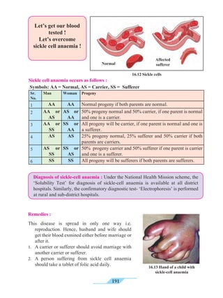 191
This disease is spread in only one way i.e.
reproduction. Hence, husband and wife should
get their blood exmined either before marriage or
after it.
1.	 A carrier or sufferer should avoid marriage with
another carrier or sufferer.
2.	 A person suffering from sickle cell anaemia
should take a tablet of folic acid daily.
Let’s get our blood
tested !
Let’s overcome
sickle cell anaemia !
16.12 Sickle cells
Normal
Affected
sufferer
Sickle cell anaemia occurs as follows :
Symbols: AA = Normal, AS = Carrier, SS = Sufferer
Sr.
No.
Man Woman Progeny
1 AA AA Normal progeny if both parents are normal.
2 AA or
AS
AS or
AA
50% progeny normal and 50% carrier, if one parent is normal
and one is a carrier.
3 AA or
SS
SS or
AA
All progeny will be carrier, if one parent is normal and one is
a sufferer.
4 AS AS 25% progeny normal, 25% sufferer and 50% carrier if both
parents are carriers.
5 AS or
SS
SS or
AS
50% progeny carrier and 50% sufferer if one parent is carrier
and one is a sufferer.
6 SS SS All progeny will be sufferers if both parents are sufferers.
Diagnosis of sickle-cell anaemia : Under the National Health Mission scheme, the
‘Solubility Test’ for diagnosis of sickle-cell anaemia is available at all district
hospitals. Similarly, the confirmatory diagnostic test- ‘Electrophoresis’ is performed
at rural and sub-district hospitals.
Remedies :
16.13 Hand of a child with
sickle-cell anaemia
 