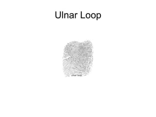 Ulnar Loop