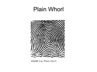 Plain Whorl