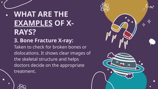 X Rays Explained FULL EXPLANATION ABOUT X-RAYS GRADE 10 SCIENCE | PPTX