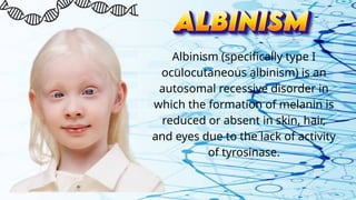Albinism (specifically type I
oculocutaneous albinism) is an
autosomal recessive disorder in
which the formation of melanin is
reduced or absent in skin, hair,
and eyes due to the lack of activity
of tyrosinase.
 