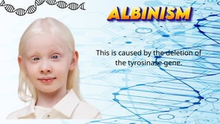 This is caused by the deletion of
the tyrosinase gene.
 