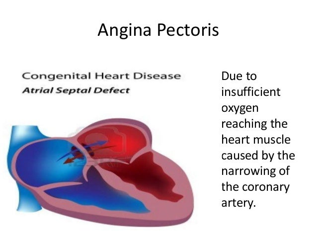 circulatory ailments