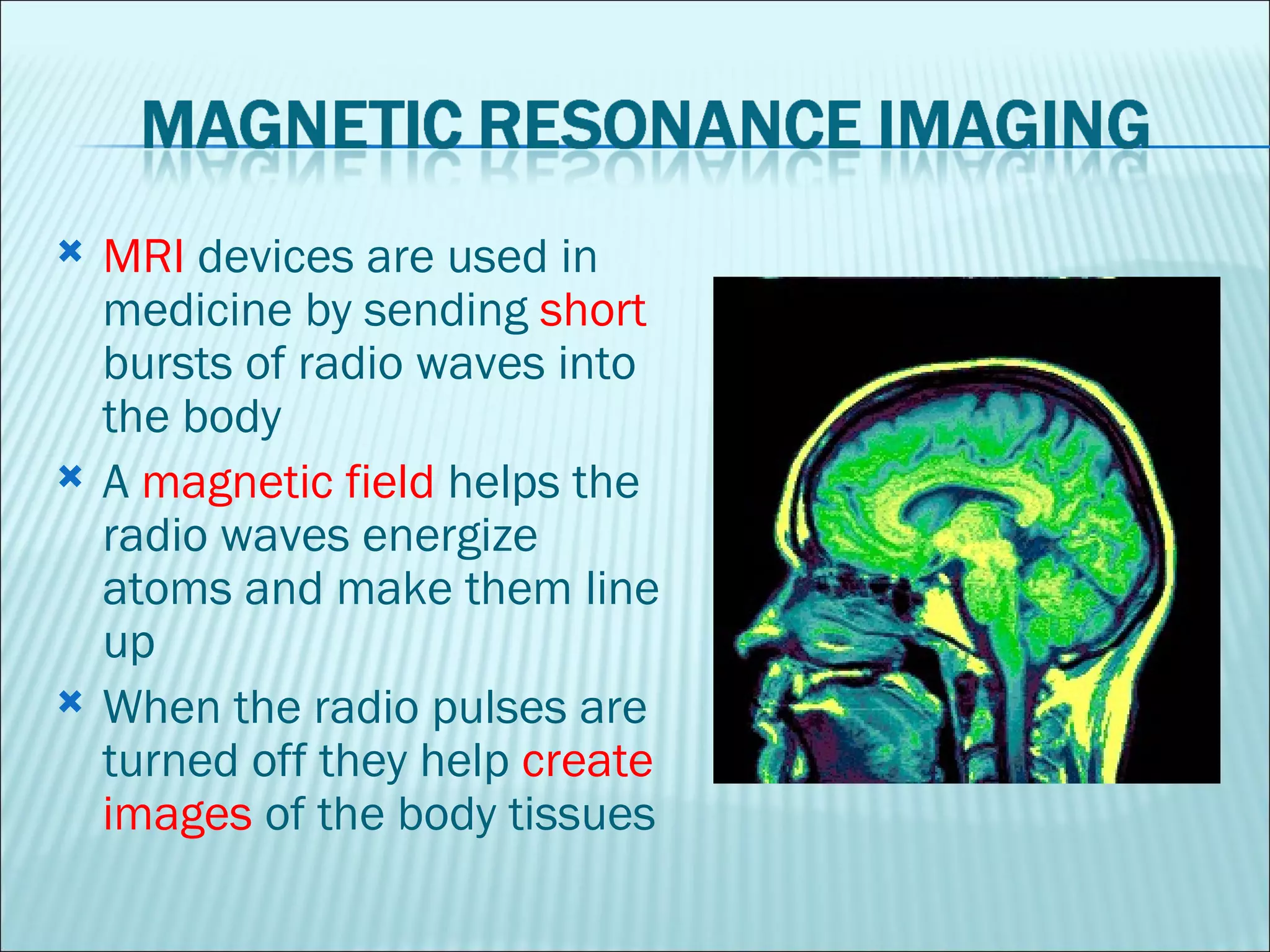 MRI  devices are used in medicine by sending  short  bursts of radio waves into the body A  magnetic field  helps the radio waves energize atoms and make them line up When the radio pulses are turned off they help  create images  of the body tissues 