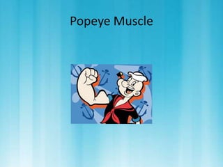 Popeye Muscle 
 