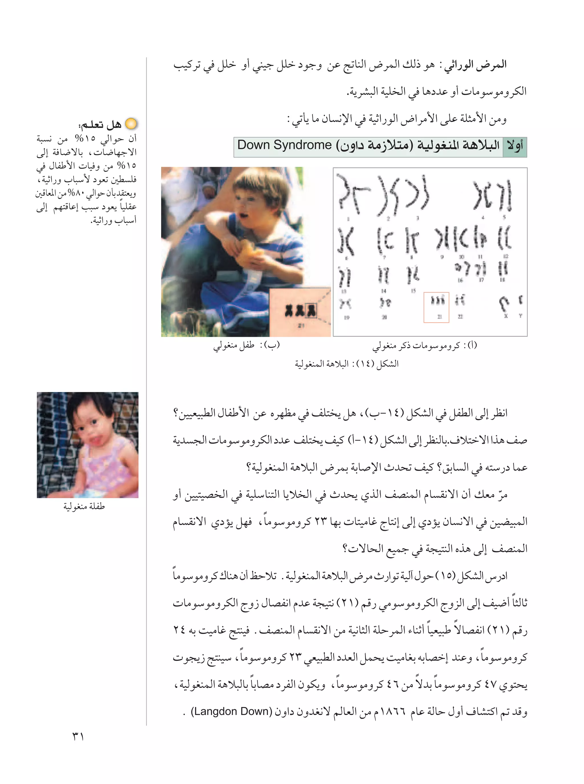 VOÂdð w qKš Ë√ wMOł qKš œułË sŽ ZðUMÃ« ÷dLÃ« pÃ– u¼ ∫wŁ«—uÃ« ÷dLÃ«

                                                                           .W¹dA³Ã« WOK Ã« w U¼œbŽ Ë√  UÄuÝuÄËdJÃ«

            ∫r?KFð q¼                                       ∫wðQ¹ UÄ ÊU ½ù« w WOŁ«—uÃ« ÷«dÄ_« vKŽ WK¦Ä_« sÄË
W³ ½ sÄ %±µ wÃ«uŠ Ê√
vÃ≈ W U{ôUÐ ¨ U{UNłô«
                                               Down Syndrome ©ÊË«œ WÄ“ö²Ä® WOÃuGM*« W¼ö³Ã«                     ôË√
w ‰UHÞ_«  UO Ë sÄ %±µ
¨WOŁ«—Ë »U³Ý_ œuFð 5D K
5ÁUF*« sÄ %∏∞ wÃ«uŠ ÊQÐ bI²F¹Ë
                         Î
vÃ≈ rN²ÁUŽ≈ V³Ý œuF¹ UOKIŽ
               .WOŁ«—Ë »U³Ý√




                                          wÃuGMÄ qHÞ ∫©»®                         wÃuGMÄ dÂ–  UÄuÝuÄËdÂ ∫©√®
                                                              WOÃuGMLÃ« W¼ö³Ã« ∫©±¥® qJAÃ«



                                 øsOOFO³DÃ« ‰UHÞ_« sŽ ÁdNEÄ w nK² ¹ q¼ ¨©»≠±¥® qJAÃ« w qHDÃ« vÃ≈ dE½«

                                 W¹b −Ã«  UÄuÝuÄËdJÃ« œbŽ nK² ¹ nOÂ ©√≠±¥® qJAÃ« vÃ≈ dEMÃUÐ.·ö²šô« «c¼ n

                                                 øWOÃuGMLÃ« W¼ö³Ã« ÷dLÐ WÐU ù« Àb×ð nOÂ øoÐU Ã« w t²Ý—œ ULŽ

                                 Ë√ sOO²OB Ã« w WOKÝUM²Ã« U¹ö Ã« w Àb×¹ ÍcÃ« nBMLÃ« ÂU I½ô« Ê√ pFÄ dÄ
                                                                                                   Ò
        WOÃuGMÄ WKHÞ
                                                  Î
                                 ÂU I½ô« ÍœR¹ qN ¨UÄuÝuÄËdÂ ≤≥ UNÐ  U²OÄUž ÃU²½≈ vÃ≈ ÍœR¹ ÊU ½ô« w sOCO³LÃ«

                                                                          ø ôU×Ã« lOLł w W−O²MÃ« Ác¼ vÃ≈ nBMLÃ«
                                 Î
                                 UÄuÝuÄËdÂ „UM¼ Ê√ kŠöð ÆWOÃuGMLÃ« W¼ö³Ã« ÷dÄ À—«uð WOÃ¬ ‰uŠ ©±µ® qJAÃ« ”—œ«
                                                                                                       Î
                                  UÄuÝuÄËdJÃ« ÃË“ ‰UBH½« ÂbŽ W−O²½ ©≤±® rÁ— wÄuÝuÄËdJÃ« ÃËeÃ« vÃ≈ nO{√ U¦ÃUŁ
                                                                                           Î      Î
                                 ≤¥ tÐ XOÄUž Z²MO ÆnBMLÃ« ÂU I½ô« sÄ WO½U¦Ã« WKŠdLÃ« ¡UMŁ√ UOFO³Þ ôUBH½« ©≤±® rÁ—
                                              Î                                                   Î
                                  u−¹“ Z²MOÝ ¨UÄuÝuÄËdÂ ≤≥ wFO³DÃ« œbFÃ« qL×¹ XOÄUGÐ tÐUBš≈ bMŽË ¨UÄuÝuÄËdÂ
                                                    Î                  Î               Î Î
                                 ¨WOÃuGMLÃ« W¼ö³ÃUÐ UÐUBÄ œdHÃ« ÊuJ¹Ë ¨UÄuÝuÄËdÂ ¥∂ sÄ ôbÐ UÄuÝuÄËdÂ ¥∑ Íu²×¹

                                  Æ (Langdon Down) ÊË«œ ÊËbG½ô rÃUFÃ« sÄ Â±∏∂∂ ÂUŽ WÃUŠ ‰Ë√ ·UA²Â« rð bÁË
          ≥±
 