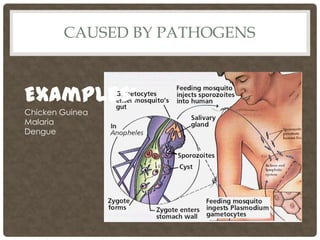CAUSED BY PATHOGENS



Examples:
Chicken Guinea
Malaria
Dengue
 