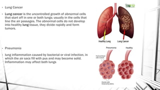 • Lung Cancer
• Lung cancer is the uncontrolled growth of abnormal cells
that start off in one or both lungs; usually in the cells that
line the air passages. The abnormal cells do not develop
into healthy lung tissue, they divide rapidly and form
tumors.
• Pneumonia
• lung inflammation caused by bacterial or viral infection, in
which the air sacs fill with pus and may become solid.
Inflammation may affect both lungs
 