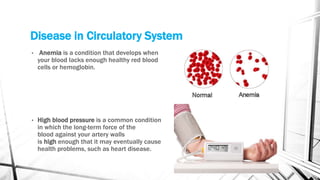 Disease in Circulatory System
• Anemia is a condition that develops when
your blood lacks enough healthy red blood
cells or hemoglobin.
• High blood pressure is a common condition
in which the long-term force of the
blood against your artery walls
is high enough that it may eventually cause
health problems, such as heart disease.
 