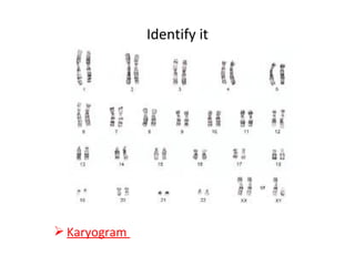 Identify it
 Karyogram
 
