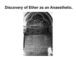 Discovery of Ether as an Anaesthetic.
 