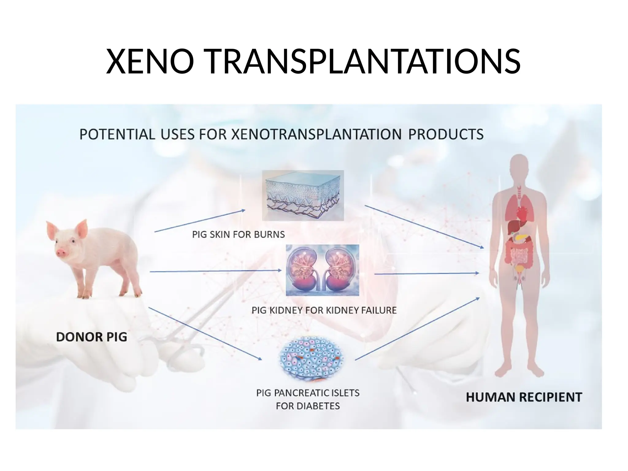 XENO TRANSPLANTATIONS
 