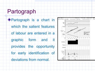 Scientific basis for intranatal care | PPT