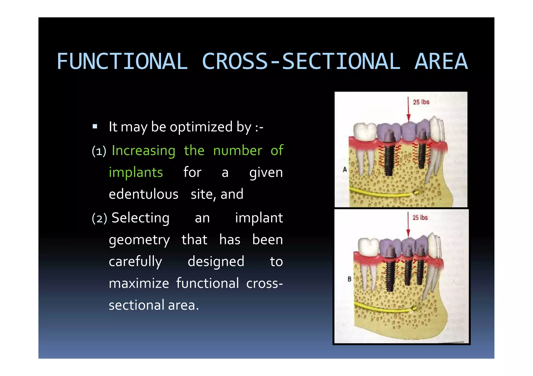 Scientific rationale and biomechanics in implants | PDF