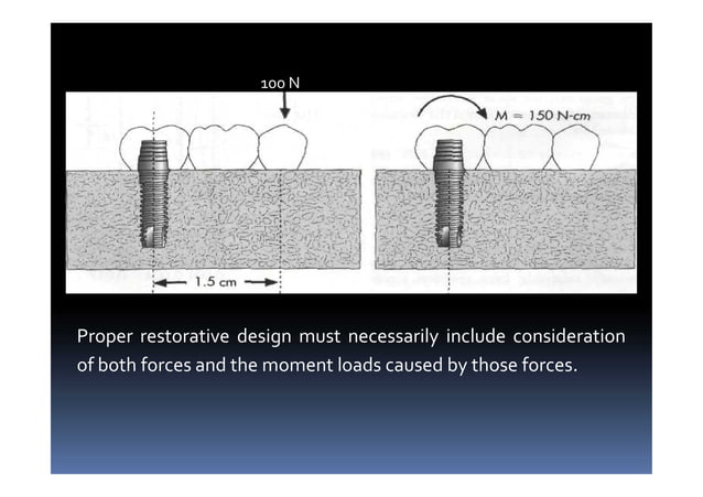 Scientific rationale and biomechanics in implants | PDF