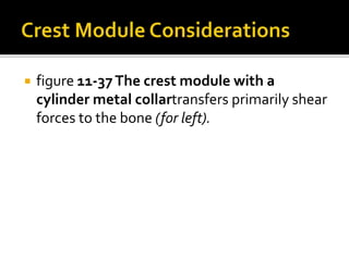  figure 11-37The crest module with a
cylinder metal collartransfers primarily shear
forces to the bone (for left).
 