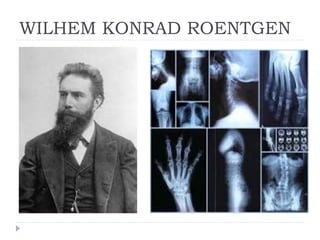 WILHEM KONRAD ROENTGEN
 