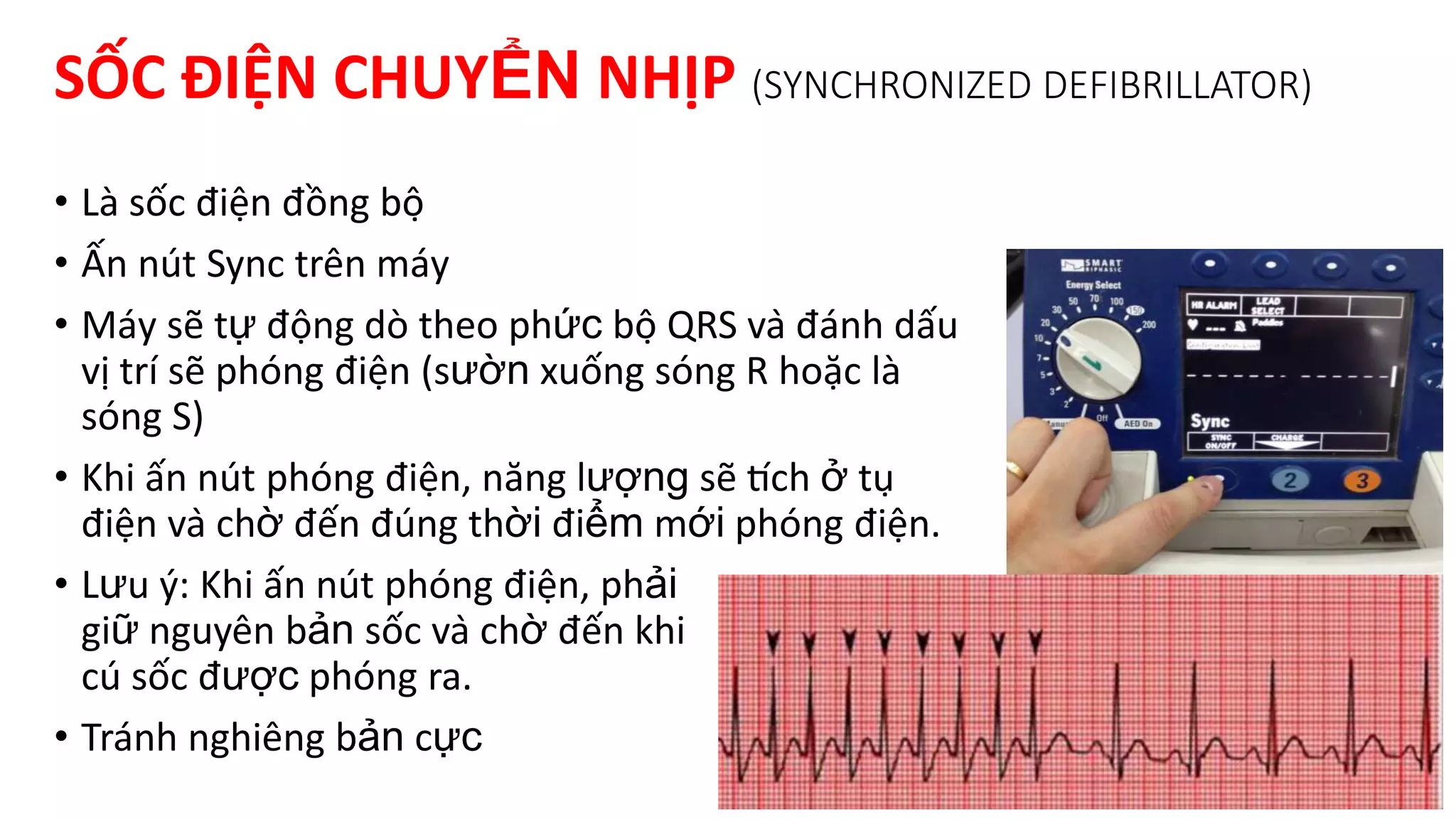 Sốc điện | PPTX